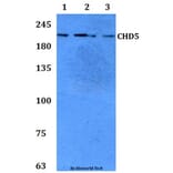 Anti-CHD5 Antibody from Bioworld Technology (BS61302) - Antibodies.com