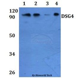 Anti-DSG4 Antibody from Bioworld Technology (BS61306) - Antibodies.com