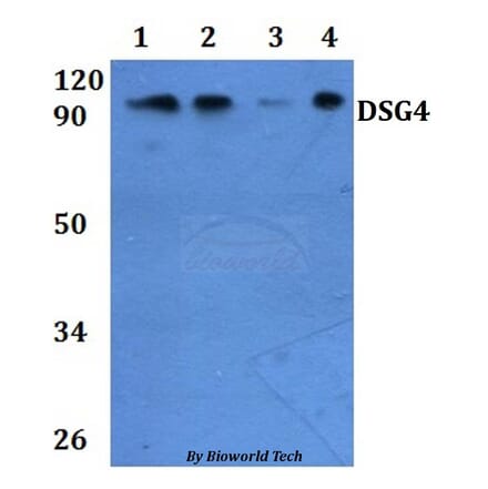 Anti-DSG4 Antibody from Bioworld Technology (BS61306) - Antibodies.com