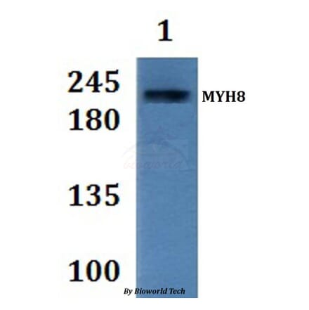 Anti-MYH8 Antibody from Bioworld Technology (BS61311) - Antibodies.com