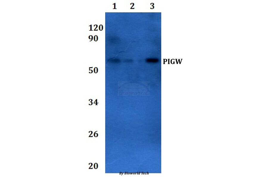 Anti-PIGW Antibody from Bioworld Technology (BS61315) - Antibodies.com