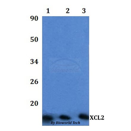 Anti-XCL2 Antibody from Bioworld Technology (BS61322) - Antibodies.com