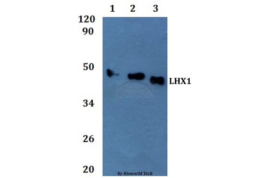 Anti-LHX1 Antibody from Bioworld Technology (BS61324) - Antibodies.com