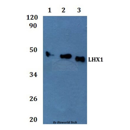 Anti-LHX1 Antibody from Bioworld Technology (BS61324) - Antibodies.com