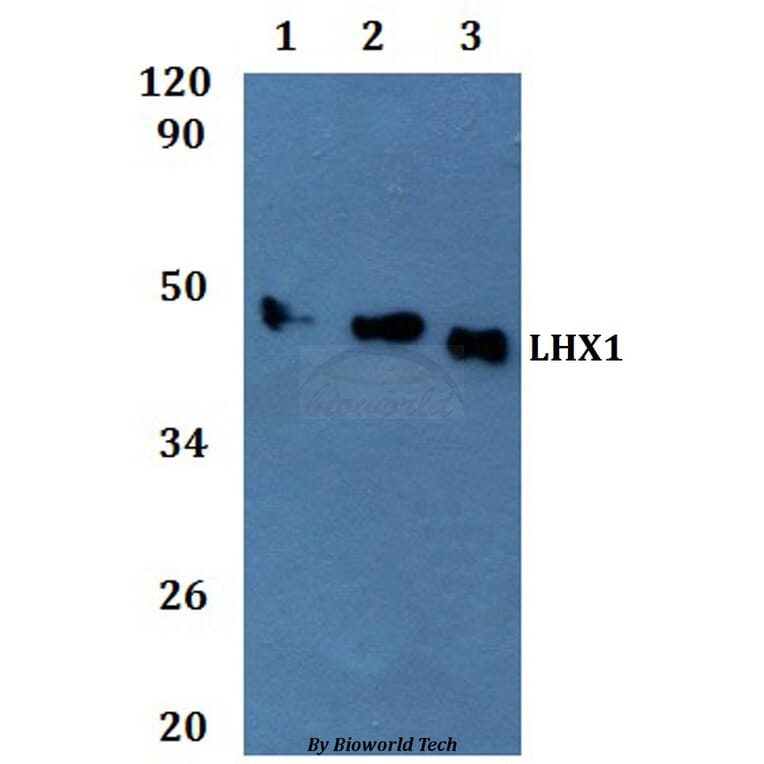Anti-LHX1 Antibody from Bioworld Technology (BS61324) - Antibodies.com