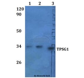 Anti-TPSG1 Antibody from Bioworld Technology (BS61326) - Antibodies.com