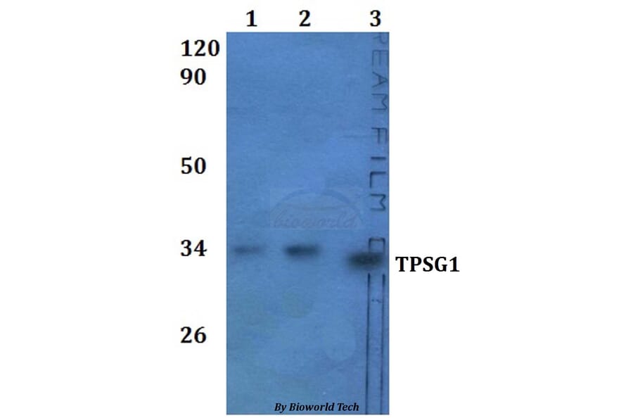 Anti-TPSG1 Antibody from Bioworld Technology (BS61326) - Antibodies.com