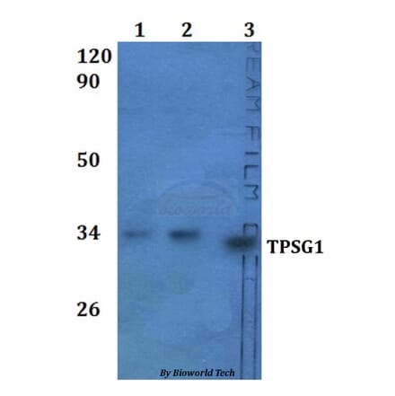 Anti-TPSG1 Antibody from Bioworld Technology (BS61326) - Antibodies.com
