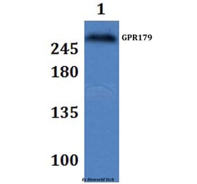 Anti-GPR179 Antibody from Bioworld Technology (BS61329) - Antibodies.com