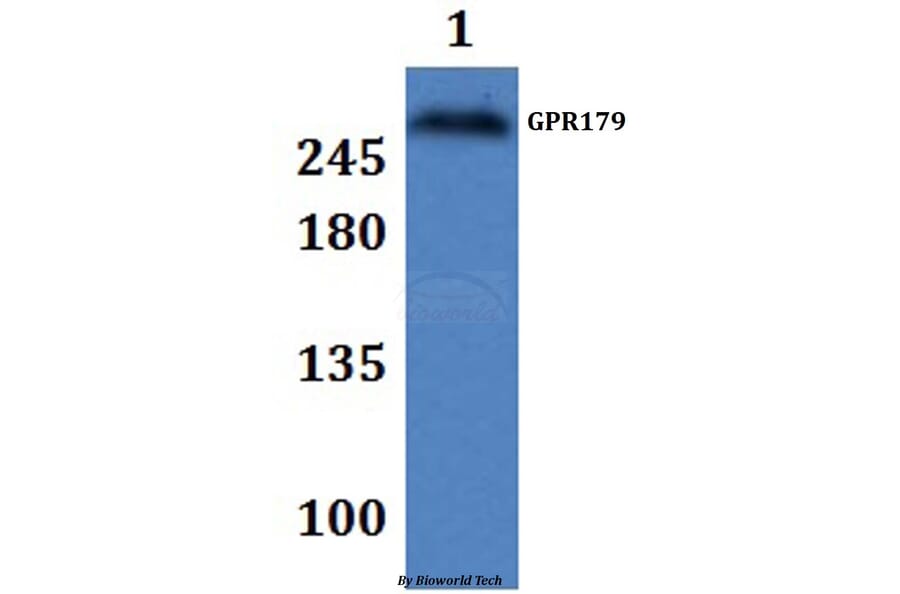 Anti-GPR179 Antibody from Bioworld Technology (BS61329) - Antibodies.com