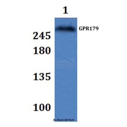 Anti-GPR179 Antibody from Bioworld Technology (BS61329) - Antibodies.com