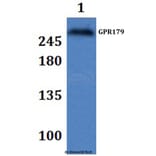 Anti-GPR179 Antibody from Bioworld Technology (BS61329) - Antibodies.com