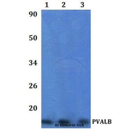 Anti-PVALB Antibody from Bioworld Technology (BS61332) - Antibodies.com