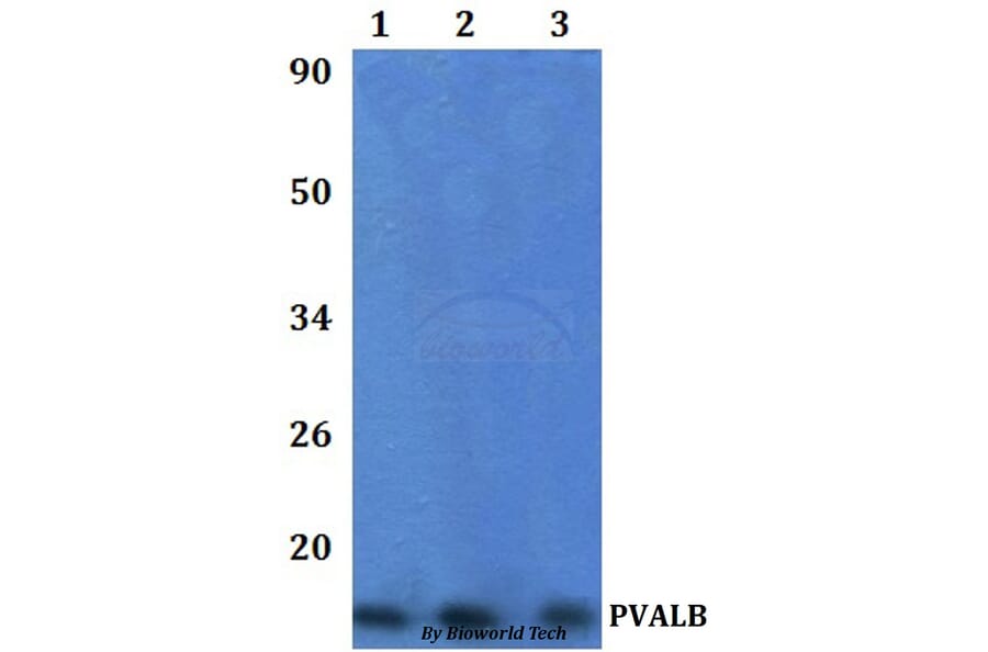 Anti-PVALB Antibody from Bioworld Technology (BS61332) - Antibodies.com
