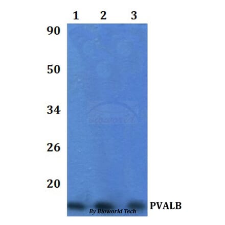 Anti-PVALB Antibody from Bioworld Technology (BS61332) - Antibodies.com