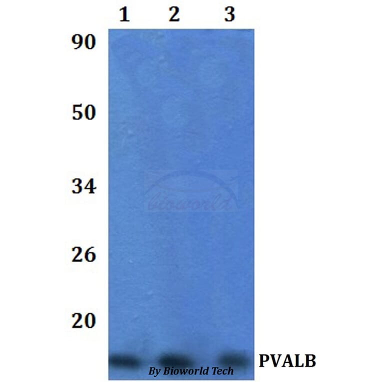 Anti-PVALB Antibody from Bioworld Technology (BS61332) - Antibodies.com