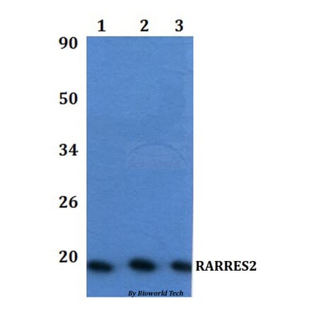 Anti-RARRES2 Antibody from Bioworld Technology (BS61334) - Antibodies.com