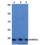 Anti-RARRES2 Antibody from Bioworld Technology (BS61334) - Antibodies.com