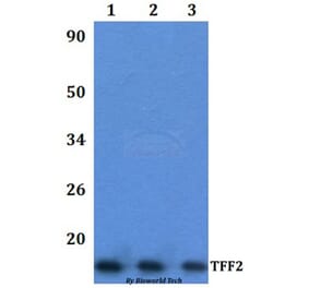 Anti-TFF2 Antibody from Bioworld Technology (BS61335) - Antibodies.com