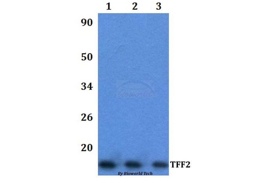 Anti-TFF2 Antibody from Bioworld Technology (BS61335) - Antibodies.com