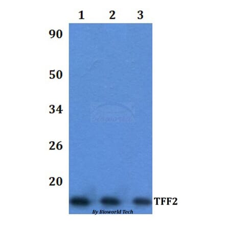 Anti-TFF2 Antibody from Bioworld Technology (BS61335) - Antibodies.com