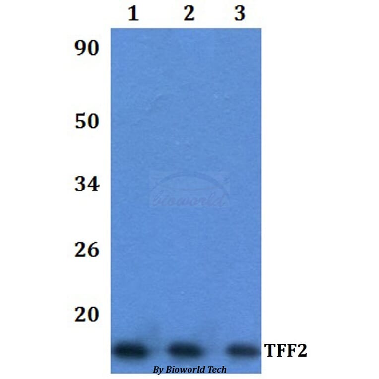 Anti-TFF2 Antibody from Bioworld Technology (BS61335) - Antibodies.com