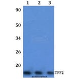 Anti-TFF2 Antibody from Bioworld Technology (BS61335) - Antibodies.com