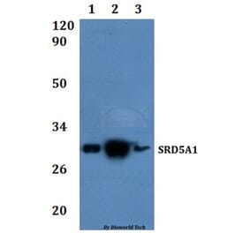 Anti-SRD5A1 Antibody from Bioworld Technology (BS61336) - Antibodies.com