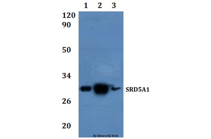 Anti-SRD5A1 Antibody from Bioworld Technology (BS61336) - Antibodies.com