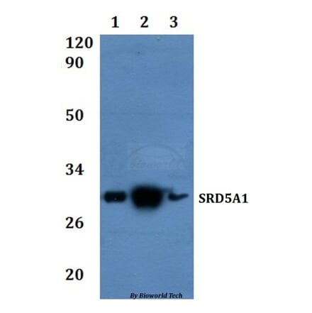 Anti-SRD5A1 Antibody from Bioworld Technology (BS61336) - Antibodies.com