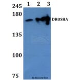 Anti-DROSHA Antibody from Bioworld Technology (BS61337) - Antibodies.com