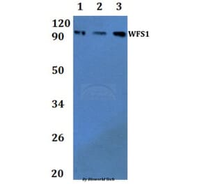 Anti-WFS1 Antibody from Bioworld Technology (BS61338) - Antibodies.com
