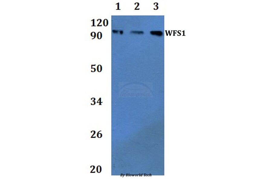 Anti-WFS1 Antibody from Bioworld Technology (BS61338) - Antibodies.com