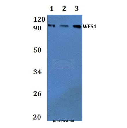 Anti-WFS1 Antibody from Bioworld Technology (BS61338) - Antibodies.com