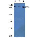Anti-WFS1 Antibody from Bioworld Technology (BS61338) - Antibodies.com