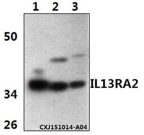 Anti-IL13RA2 Antibody from Bioworld Technology (BS61342) - Antibodies.com