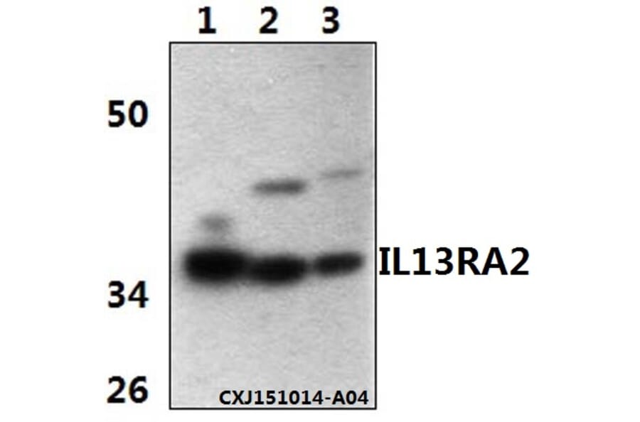 Anti-IL13RA2 Antibody from Bioworld Technology (BS61342) - Antibodies.com