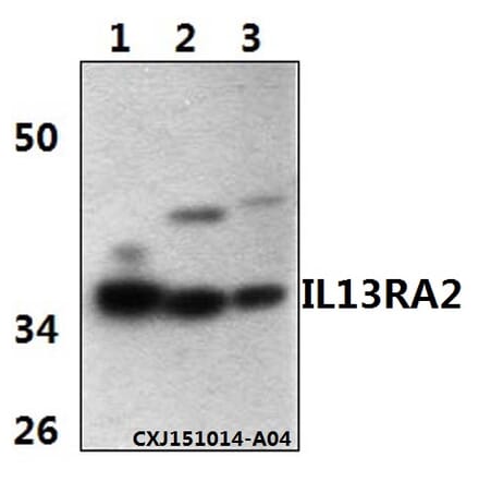 Anti-IL13RA2 Antibody from Bioworld Technology (BS61342) - Antibodies.com
