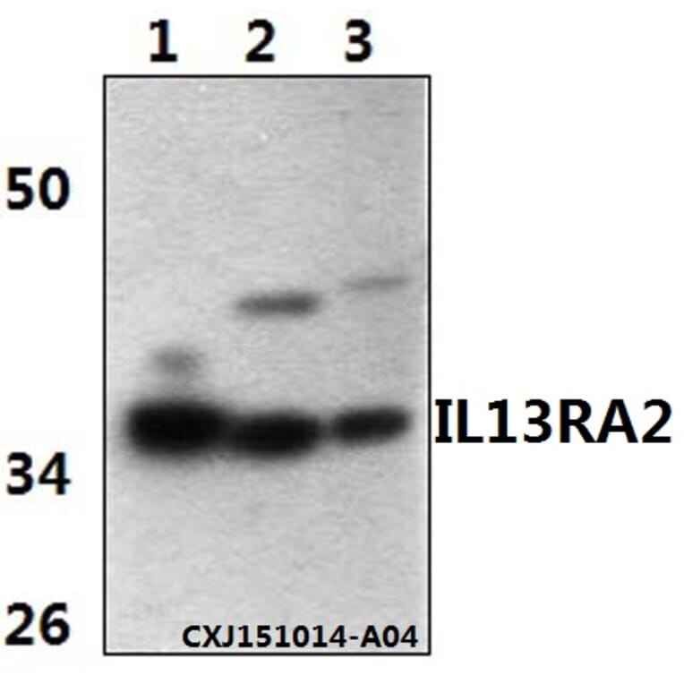 Anti-IL13RA2 Antibody from Bioworld Technology (BS61342) - Antibodies.com