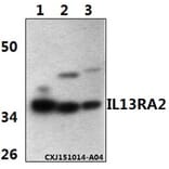 Anti-IL13RA2 Antibody from Bioworld Technology (BS61342) - Antibodies.com