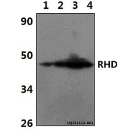 Anti-RHD Antibody from Bioworld Technology (BS61343) - Antibodies.com