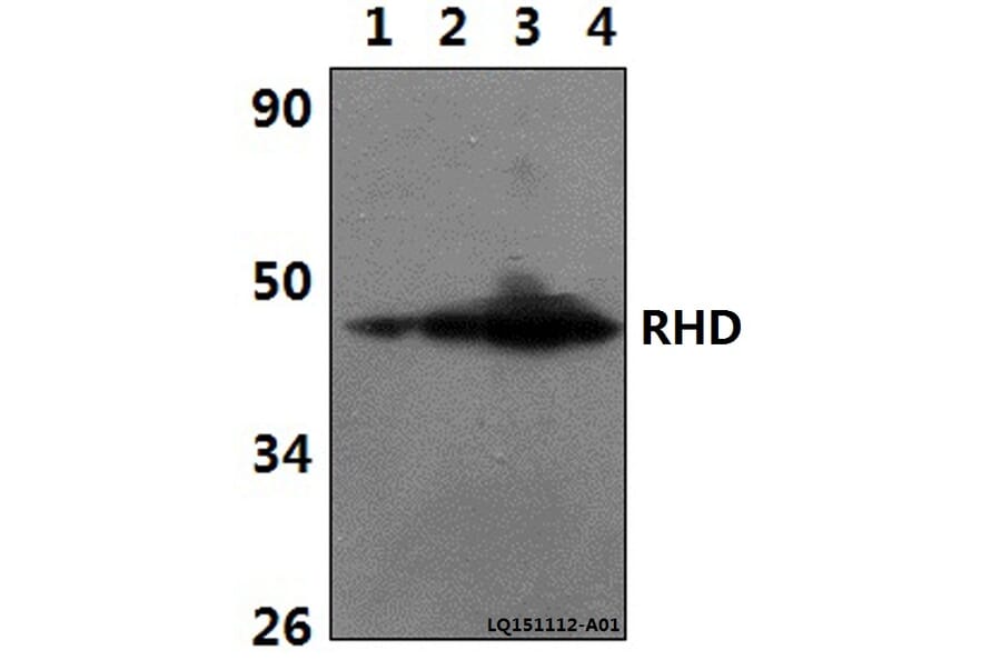Anti-RHD Antibody from Bioworld Technology (BS61343) - Antibodies.com