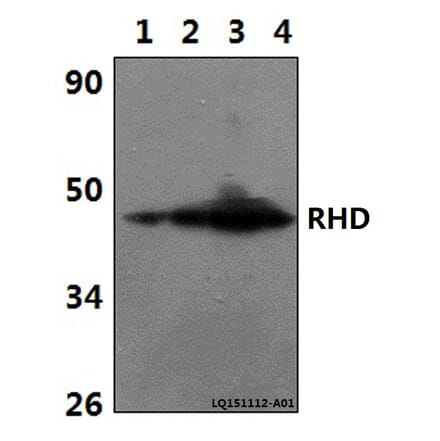 Anti-RHD Antibody from Bioworld Technology (BS61343) - Antibodies.com