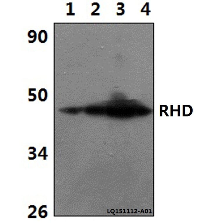 Anti-RHD Antibody from Bioworld Technology (BS61343) - Antibodies.com