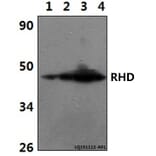 Anti-RHD Antibody from Bioworld Technology (BS61343) - Antibodies.com