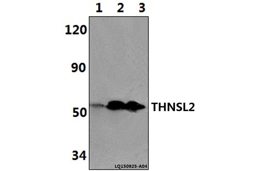 Anti-THNSL2 Antibody from Bioworld Technology (BS61346) - Antibodies.com