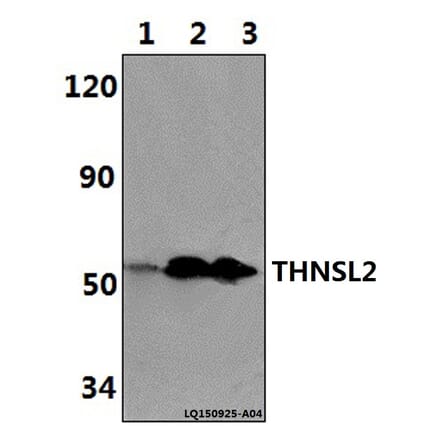 Anti-THNSL2 Antibody from Bioworld Technology (BS61346) - Antibodies.com