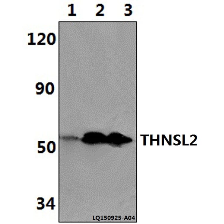 Anti-THNSL2 Antibody from Bioworld Technology (BS61346) - Antibodies.com