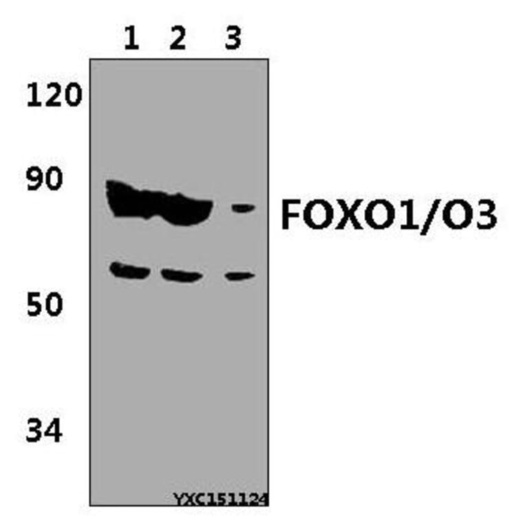Anti-FOXO1/O3 Antibody from Bioworld Technology (BS61349) - Antibodies.com