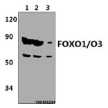 Anti-FOXO1/O3 Antibody from Bioworld Technology (BS61349) - Antibodies.com